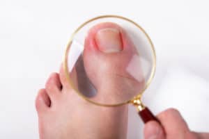 An Overhead View Of Person's Hand Holding Magnifying Glass Over Sore Toe Nail On Floor