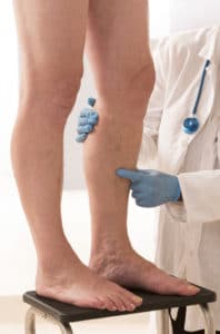 Lower limb vascular examination