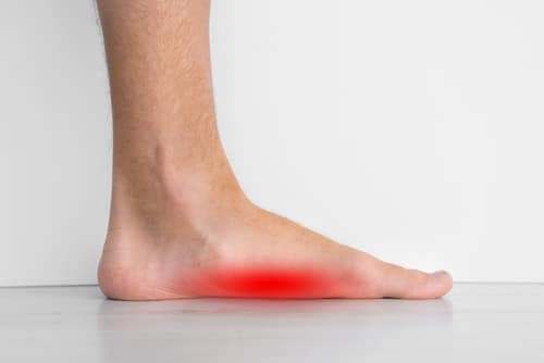 Do You Have Flat Feet? - Foot & Ankle Clinics of Utah