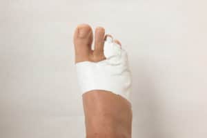 Man’s foot bandaged up on his broken toe