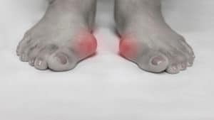 excessive pronation foot and ankle clinics utah